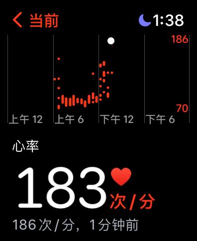 如果Apple Watch的传感器没问题的话我应该去医院看看了（